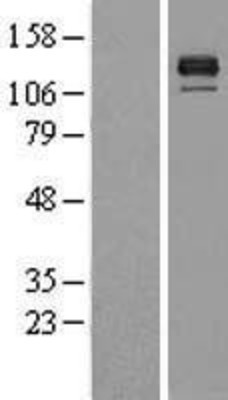 Western Blot: BMPR2 Overexpression Lysate (Adult Normal) [NBL1-08009] Left-Empty vector transfected control cell lysate (HEK293 cell lysate); Right -Over-expression Lysate for BMPR2.