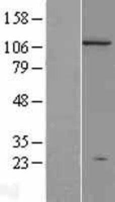 Western Blot: Dnmt3a Overexpression Lysate (Adult Normal) [NBL1-09970] Left-Empty vector transfected control cell lysate (HEK293 cell lysate); Right -Over-expression Lysate for Dnmt3a.