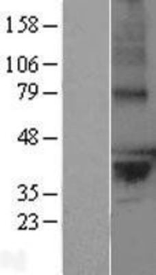 Western Blot: LPPR2 Overexpression Lysate (Adult Normal) [NBL1-12657] Left-Empty vector transfected control cell lysate (HEK293 cell lysate); Right -Over-expression Lysate for LPPR2.