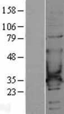 Western Blot: CACNG6 Overexpression Lysate (Adult Normal) [NBL1-08634] Left-Empty vector transfected control cell lysate (HEK293 cell lysate); Right -Over-expression Lysate for CACNG6.