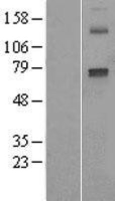 Western Blot: Cytochrome P450 2E1 Overexpression Lysate (Adult Normal) [NBL1-09687] Left-Empty vector transfected control cell lysate (HEK293 cell lysate); Right -Over-expression Lysate for Cytochrome P450 2E1.