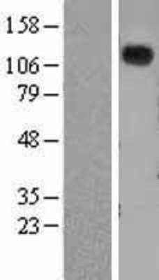 Western Blot: Natriuretic Peptide Receptor A Overexpression Lysate (Adult Normal) [NBL1-13754] Left-Empty vector transfected control cell lysate (HEK293 cell lysate); Right -Over-expression Lysate for Natriuretic Peptide Receptor A.