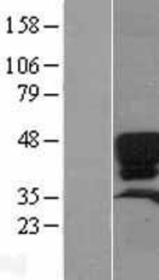 Western Blot: Surfactant protein D Overexpression Lysate (Adult Normal) [NBL1-15897] Left-Empty vector transfected control cell lysate (HEK293 cell lysate); Right -Over-expression Lysate for Surfactant protein D.