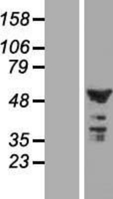 Western Blot: C2orf29 Overexpression Lysate (Adult Normal) [NBL1-08408] Left-Empty vector transfected control cell lysate (HEK293 cell lysate); Right -Over-expression Lysate for C2orf29.