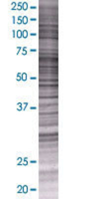 HDAC7A transfected lysate.