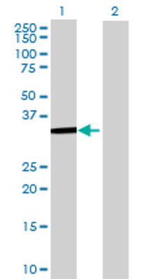 Lane 1: HDAC7A transfected lysate (30.47 KDa) Lane 2: Non-transfected lysate.