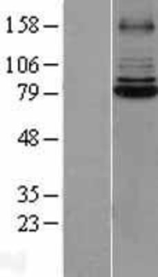 Western Blot: IRAK Overexpression Lysate (Adult Normal) [NBL1-12025] Left-Empty vector transfected control cell lysate (HEK293 cell lysate); Right -Over-expression Lysate for IRAK.