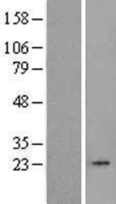 Western Blot: TBP like protein TLP Overexpression Lysate (Adult Normal) [NBL1-16742] Left-Empty vector transfected control cell lysate (HEK293 cell lysate); Right -Over-expression Lysate for TBP like protein TLP.