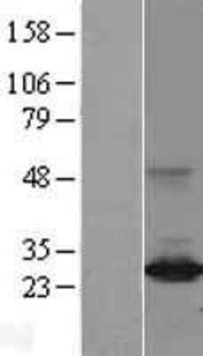 Western Blot: DIRAS3 Overexpression Lysate (Adult Normal) [NBL1-09891] Left-Empty vector transfected control cell lysate (HEK293 cell lysate); Right -Over-expression Lysate for DIRAS3.