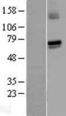 Western Blot: Guanylyl Cyclase alpha 1 Overexpression Lysate (Adult Normal) [NBL1-11407] Left-Empty vector transfected control cell lysate (HEK293 cell lysate); Right -Over-expression Lysate for Guanylyl Cyclase alpha 1.