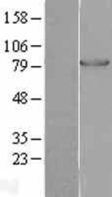 Western Blot: PFK-1 Overexpression Lysate (Adult Normal) [NBL1-14316] Left-Empty vector transfected control cell lysate (HEK293 cell lysate); Right -Over-expression Lysate for PFK-1.