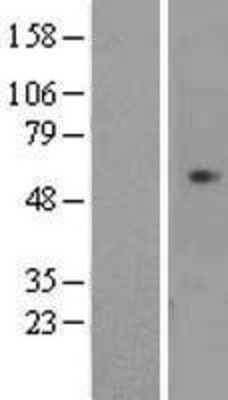 Western Blot: CDCA7L Overexpression Lysate (Adult Normal) [NBL1-09021] Left-Empty vector transfected control cell lysate (HEK293 cell lysate); Right -Over-expression Lysate for CDCA7L.