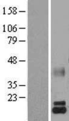 Western Blot: Lactalbumin Alpha Overexpression Lysate (Adult Normal) [NBL1-12427] Left-Empty vector transfected control cell lysate (HEK293 cell lysate); Right -Over-expression Lysate for Lactalbumin Alpha.