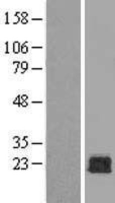 Western Blot: Rac1 Overexpression Lysate (Adult Normal) [NBL1-15105] Left-Empty vector transfected control cell lysate (HEK293 cell lysate); Right -Over-expression Lysate for Rac1.
