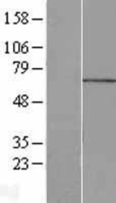 Western Blot: MPP7 Overexpression Lysate (Adult Normal) [NBL1-13206] Left-Empty vector transfected control cell lysate (HEK293 cell lysate); Right -Over-expression Lysate for MPP7.