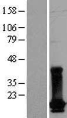 Western Blot: dUTPase Overexpression Lysate (Adult Normal) [NBL1-10060] Left-Empty vector transfected control cell lysate (HEK293 cell lysate); Right -Over-expression Lysate for dUTPase.