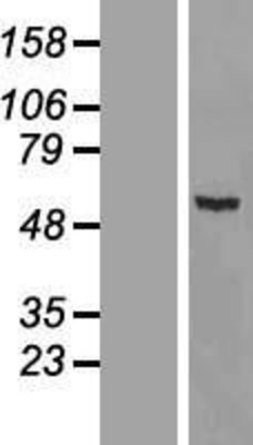 Western Blot: MYH Overexpression Lysate (Adult Normal) [NBL1-13399] Left-Empty vector transfected control cell lysate (HEK293 cell lysate); Right -Over-expression Lysate for MYH.
