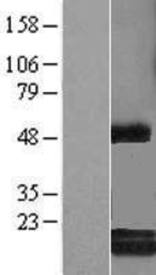 Western Blot: c-Myc-responsive protein Rcl Overexpression Lysate (Adult Normal) [NBL1-08506] Left-Empty vector transfected control cell lysate (HEK293 cell lysate); Right -Over-expression Lysate for c-Myc-responsive protein Rcl.