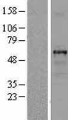 Western Blot: beta I Tubulin Overexpression Lysate (Adult Normal) [NBL1-17436] Left-Empty vector transfected control cell lysate (HEK293 cell lysate); Right -Over-expression Lysate for beta I Tubulin.