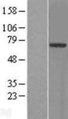 Western Blot: TRIM9 Overexpression Lysate (Adult Normal) [NBL1-17316] Left-Empty vector transfected control cell lysate (HEK293 cell lysate); Right -Over-expression Lysate for TRIM9.