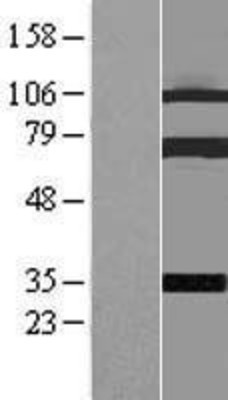 Western Blot: Coilin Overexpression Lysate (Adult Normal) [NBL1-09347] Left-Empty vector transfected control cell lysate (HEK293 cell lysate); Right -Over-expression Lysate for Coilin.
