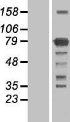 Western Blot: KHNYN Overexpression Lysate (Adult Normal) [NBL1-12242] Left-Empty vector transfected control cell lysate (HEK293 cell lysate); Right -Over-expression Lysate for KHNYN.