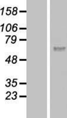 Western Blot: Calicin Overexpression Lysate (Adult Normal) [NBL1-08837] Left-Empty vector transfected control cell lysate (HEK293 cell lysate); Right -Over-expression Lysate for Calicin.