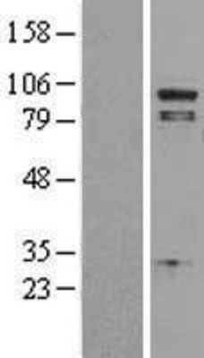 Western Blot: Phospholipase A2, group IVA Overexpression Lysate (Adult Normal) [NBL1-14474] Left-Empty vector transfected control cell lysate (HEK293 cell lysate); Right -Over-expression Lysate for Phospholipase A2, group IVA.