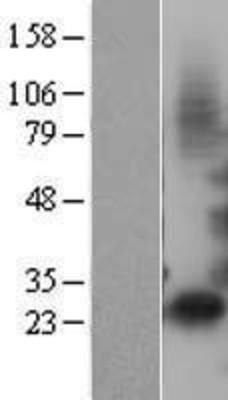 Western Blot: IGFBP1 Overexpression Lysate (Adult Normal) [NBL1-11873] Left-Empty vector transfected control cell lysate (HEK293 cell lysate); Right -Over-expression Lysate for IGFBP1.
