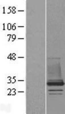 Western Blot: CHMP1B Overexpression Lysate (Adult Normal) [NBL1-09158] Left-Empty vector transfected control cell lysate (HEK293 cell lysate); Right -Over-expression Lysate for CHMP1B.