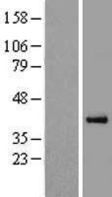 Western Blot: PON3 Overexpression Lysate (Adult Normal) [NBL1-14606] Left-Empty vector transfected control cell lysate (HEK293 cell lysate); Right -Over-expression Lysate for PON3.