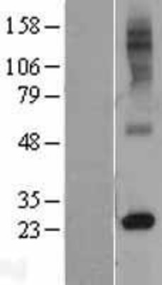 Western Blot: RTP4 Overexpression Lysate (Adult Normal) [NBL1-15618] Left-Empty vector transfected control cell lysate (HEK293 cell lysate); Right -Over-expression Lysate for RTP4.