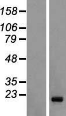 Western Blot: FAM122C Overexpression Lysate (Adult Normal) [NBL1-10459] Left-Empty vector transfected control cell lysate (HEK293 cell lysate); Right -Over-expression Lysate for FAM122C.