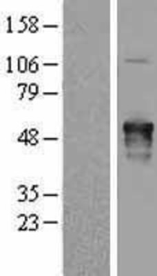 Western Blot: AKAP5 Overexpression Lysate (Adult Normal) [NBL1-07429] Left-Empty vector transfected control cell lysate (HEK293 cell lysate); Right -Over-expression Lysate for AKAP5.