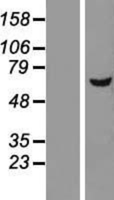 Western Blot: DEPDC7 Overexpression Lysate (Adult Normal) [NBL1-09836] Left-Empty vector transfected control cell lysate (HEK293 cell lysate); Right -Over-expression Lysate for DEPDC7.