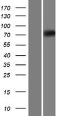 Western Blot: EOMES Overexpression Lysate (Adult Normal) [NBL1-10285] Left-Empty vector transfected control cell lysate (HEK293 cell lysate); Right -Over-expression Lysate for EOMES.