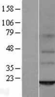 Western Blot: ORMDL2 Overexpression Lysate (Adult Normal) [NBL1-13980] Left-Empty vector transfected control cell lysate (HEK293 cell lysate); Right -Over-expression Lysate for ORMDL2.