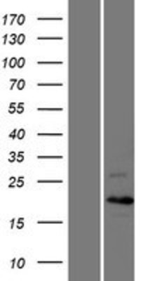 Western Blot: Cyclin C Overexpression Lysate (Adult Normal) [NBL1-08870] Left-Empty vector transfected control cell lysate (HEK293 cell lysate); Right -Over-expression Lysate for Cyclin C.