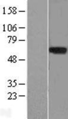 Western Blot: LRRTM1 Overexpression Lysate (Adult Normal) [NBL1-12714] Left-Empty vector transfected control cell lysate (HEK293 cell lysate); Right -Over-expression Lysate for LRRTM1.