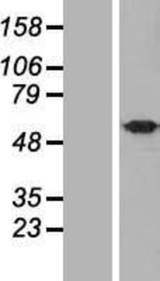 Western Blot: UBQLNL Overexpression Lysate (Adult Normal) [NBL1-17567] Left-Empty vector transfected control cell lysate (HEK293 cell lysate); Right -Over-expression Lysate for UBQLNL.