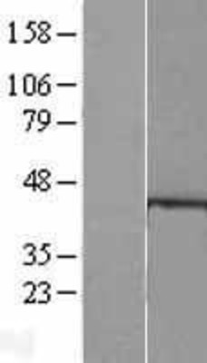 Western Blot: HDAC8 Overexpression Lysate (Adult Normal) [NBL1-11485] Left-Empty vector transfected control cell lysate (HEK293 cell lysate); Right -Over-expression Lysate for HDAC8.