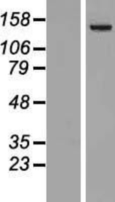 Western Blot: Phospholipase C beta 4 Overexpression Lysate (Adult Normal) [NBL1-14489] Left-Empty vector transfected control cell lysate (HEK293 cell lysate); Right -Over-expression Lysate for Phospholipase C beta 4.