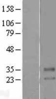 Western Blot: SLC39A2/ZIP2 Overexpression Lysate (Adult Normal) [NBL1-16145] Left-Empty vector transfected control cell lysate (HEK293 cell lysate); Right -Over-expression Lysate for SLC39A2/ZIP2.