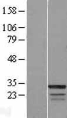 Western Blot: FAM133B Overexpression Lysate (Adult Normal) [NBL1-10474] Left-Empty vector transfected control cell lysate (HEK293 cell lysate); Right -Over-expression Lysate for FAM133B.