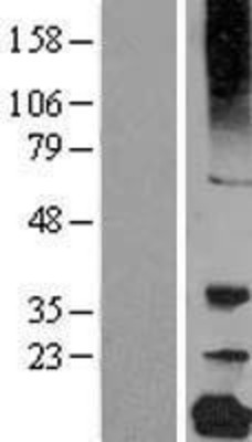 Western Blot: gamma C Crystallin Overexpression Lysate (Adult Normal) [NBL1-09501] Left-Empty vector transfected control cell lysate (HEK293 cell lysate); Right -Over-expression Lysate for gamma C Crystallin.