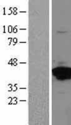 Western Blot: Annexin A2 Overexpression Lysate (Adult Normal) [NBL1-07562] Left-Empty vector transfected control cell lysate (HEK293 cell lysate); Right -Over-expression Lysate for Annexin A2.