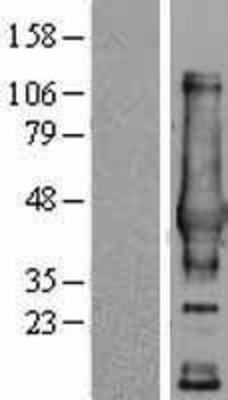 Western Blot: NDRG4 Overexpression Lysate (Adult Normal) [NBL1-13532] Left-Empty vector transfected control cell lysate (HEK293 cell lysate); Right -Over-expression Lysate for NDRG4.