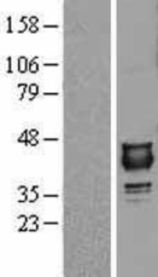 Western Blot: NUDT9 Overexpression Lysate (Adult Normal) [NBL1-13867] Left-Empty vector transfected control cell lysate (HEK293 cell lysate); Right -Over-expression Lysate for NUDT9.
