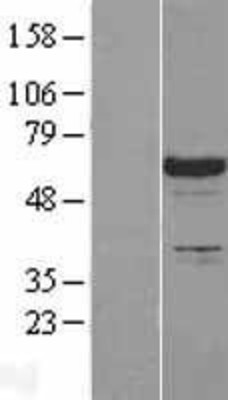Western Blot: SLP76 Overexpression Lysate (Adult Normal) [NBL1-12467] Left-Empty vector transfected control cell lysate (HEK293 cell lysate); Right -Over-expression Lysate for SLP76.