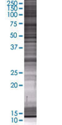 RNF144A transfected lysate.